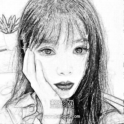 (眼部修复史)重庆美禅吴一双眼皮修复介绍展示
