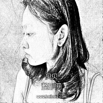 广州中山家医家庭医生整形热玛吉怎么样介绍果分享