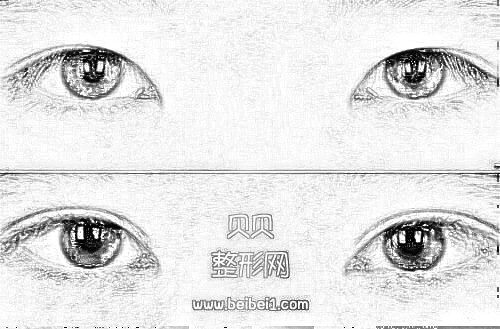 上海九院整形科割双眼皮技术怎么样？好吗？