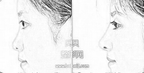 西安交大一附院整形科舒茂国割双眼皮和隆鼻怎么样？多少钱？