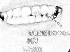 深圳世纪河山口腔牙齿矫正介绍·现在终于可以放心大胆的开怀大笑了