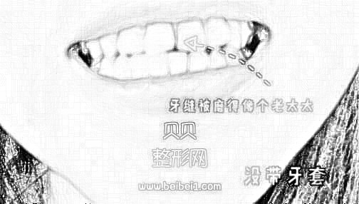 深圳世纪河山口腔牙齿矫正介绍·现在终于可以放心大胆的开怀大笑了