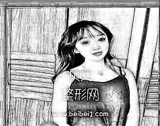 分享我在宜昌隆胸的经历,有本地的小姐姐吗?宜昌第二人民医院整形科隆胸介绍分享