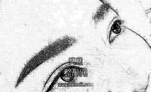 我终于摆脱了.我致命的眉毛.女士们先生们，请看!郑州美眼整形医院双眼皮纹眉介绍分享