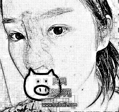 北京米扬丽格巫文云隆鼻好吗?