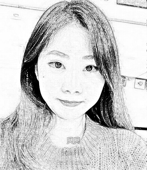 天津伊美尔外切去眼袋手术果术后3个月介绍反馈，美美哒！做完像像5年前的自己一样