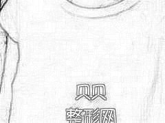 北京东方和谐_冯斌整形自体脂肪丰胸介绍分享·手术后一个月，如今我的身型大部分早已恢复了