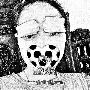 北京八大处医院靳小雷割双眼皮怎么样&介绍分享