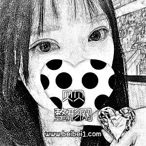 北京八大处医院靳小雷割双眼皮怎么样&介绍分享