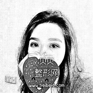 上海九院黄如林割双眼皮怎么样?好不好?多少钱?