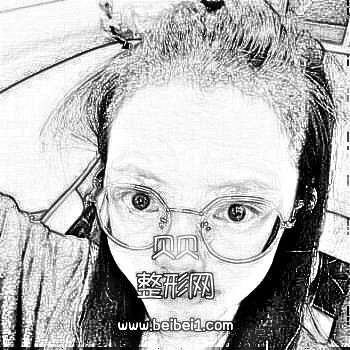 深圳雍禾植发医院收费标准以及介绍分享，头顶浓密的头发已经经历了三个月的脱发