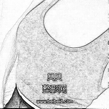 长沙真爱整形医院隆胸,_介绍
