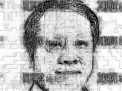 北医三院整形科李东假体隆鼻怎么样?及术后一览