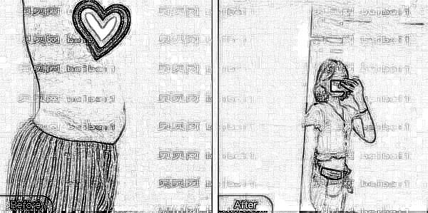 潍坊市人民医院抽脂多少钱一次？