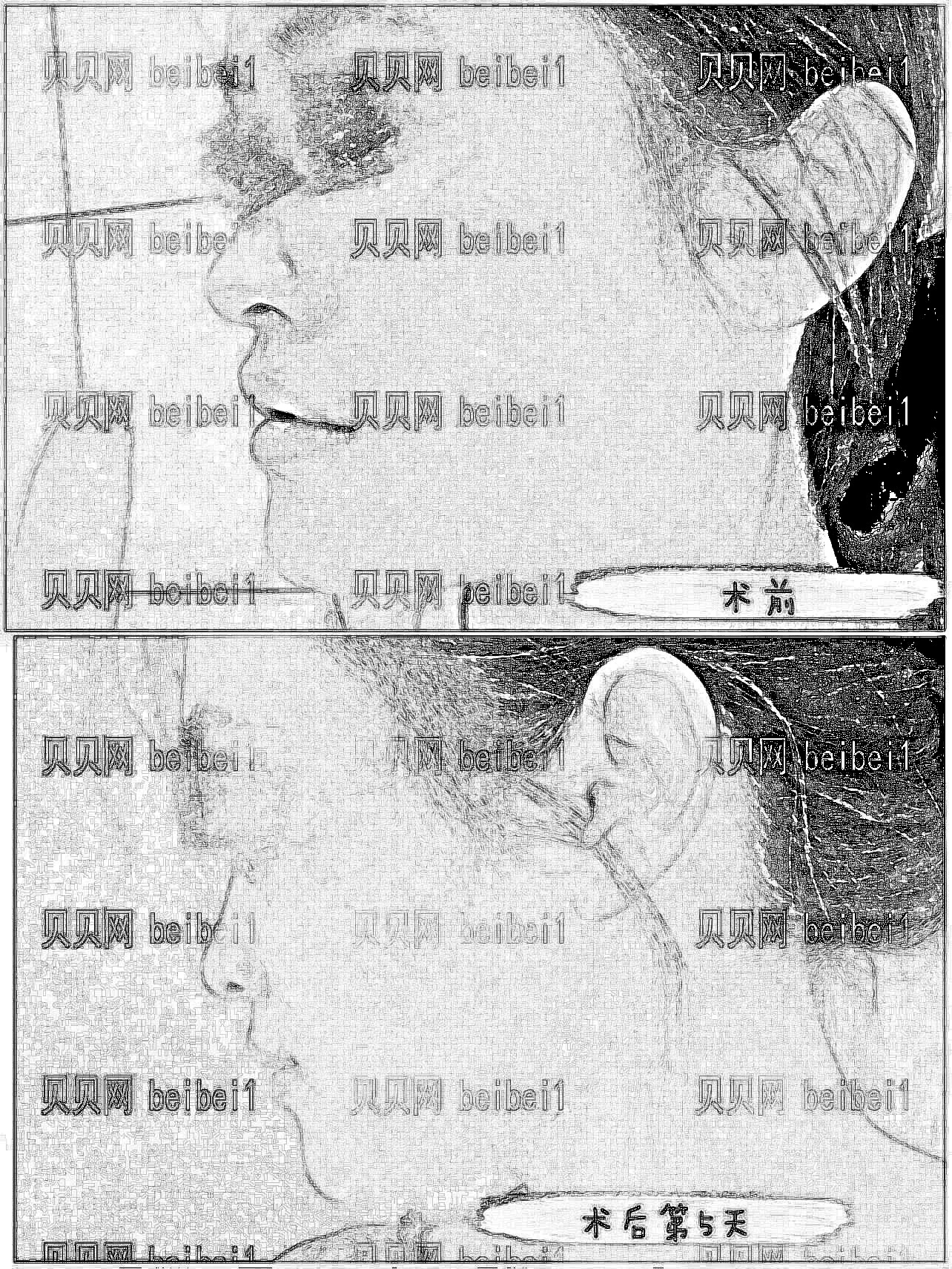 北京八大处归来磨骨削骨怎么样?多少钱?