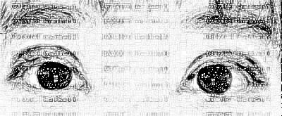 北京八大处医院靳小雷割双眼皮好吗？果怎么样？