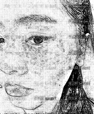 武警辽宁省总队医院整形科激光祛斑及术后介绍分享