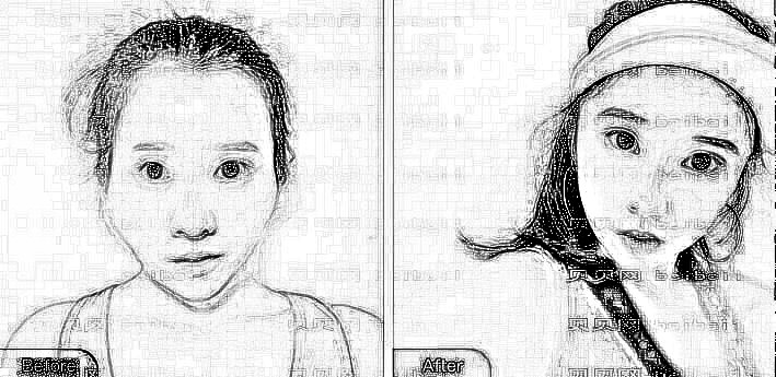 上海伯思立整形医院面部自体脂肪填充介绍.附