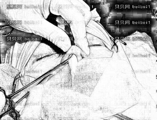 深圳悦她张赫做整形的技术怎么样?自体脂肪填充介绍分享