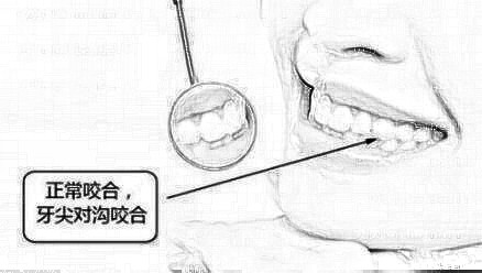深圳龙普兰特口腔医院金永勋做牙齿矫正怎么样？介绍果好吗？