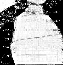深圳鹏爱医院做隆胸手术介绍 蔡国威医生技术口碑好吗?