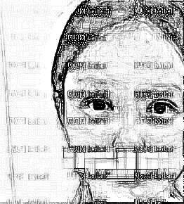 四川省人民医院整形外科做下颌角整形介绍 李继华医生技术口碑怎么样?