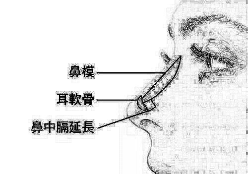 鼻部手术整形大概要多少钱?综合隆鼻价格贵吗?