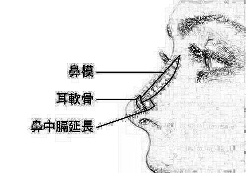 鼻部手术整形大概要多少钱?综合隆鼻价格贵吗？