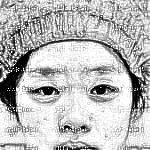 湖南省人民医院整形科李高峰割双眼皮+开眼角分享较新介绍片·淤青消的差不多了，眼睛大了很多