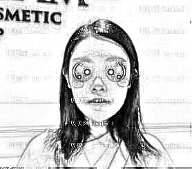 自从找何德文医生做了面部脂肪填充后,素颜出门毫无压力!