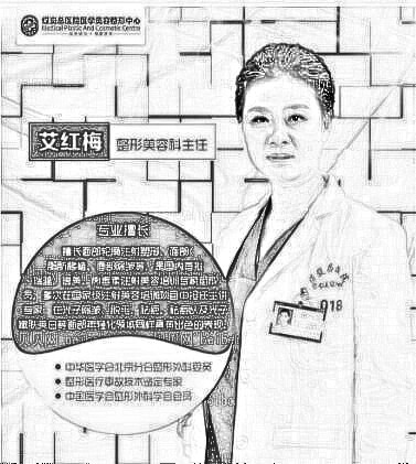 北京煤炭总医院整形科艾红梅技术怎么样