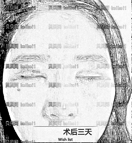 西安交大一附院整形科舒茂国割双眼皮和隆鼻靠谱吗?坐诊专家,较新统计