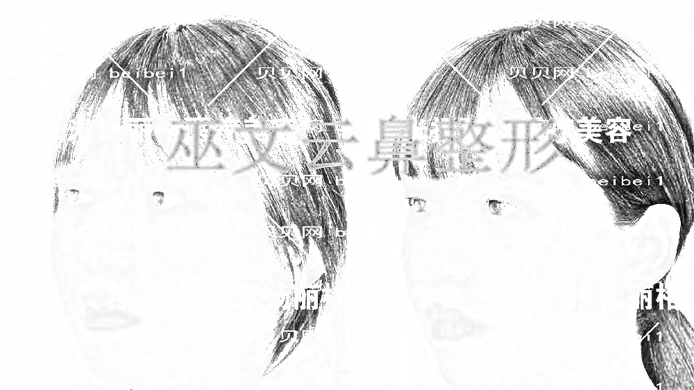 巫文云隆鼻什么价位