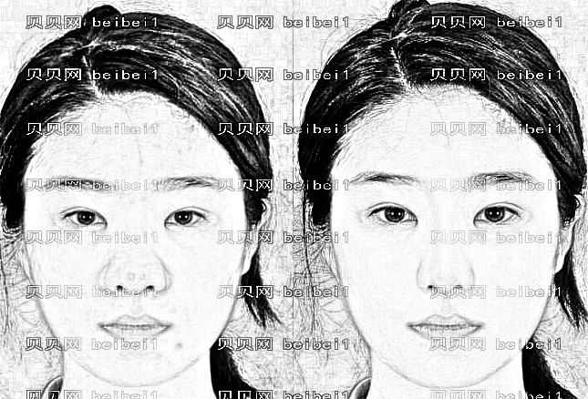 成都八大处胡琼华隆鼻价格大概多少钱？
