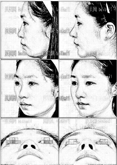 九院肖开颜擅长做隆鼻吗?技术怎么样?