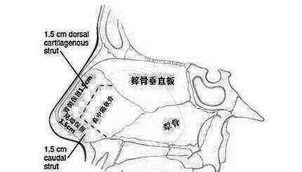 深圳yestar艺星的潘华医生个人简介，隆鼻口碑介绍评价分享！
