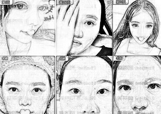深圳仁安雅医院正规吗?做双眼皮和吸脂技术怎么样？来看分析