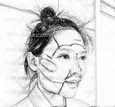 金圣整形谷利卫吸脂瘦脸介绍分享·面部吸脂+填充做完快两个月了