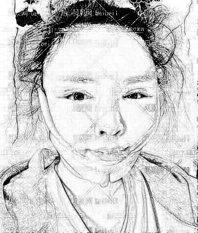 金圣整形谷利卫吸脂瘦脸介绍分享·面部吸脂+填充做完快两个月了