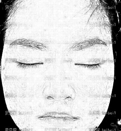 北京做的果酸焕肤98天了 痘印已经淡了很多，皮肤也比原来白皙细腻了