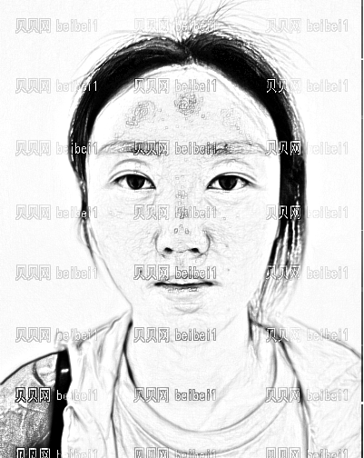南阳第三医院整形科隆鼻果怎么样？价格大概多少钱