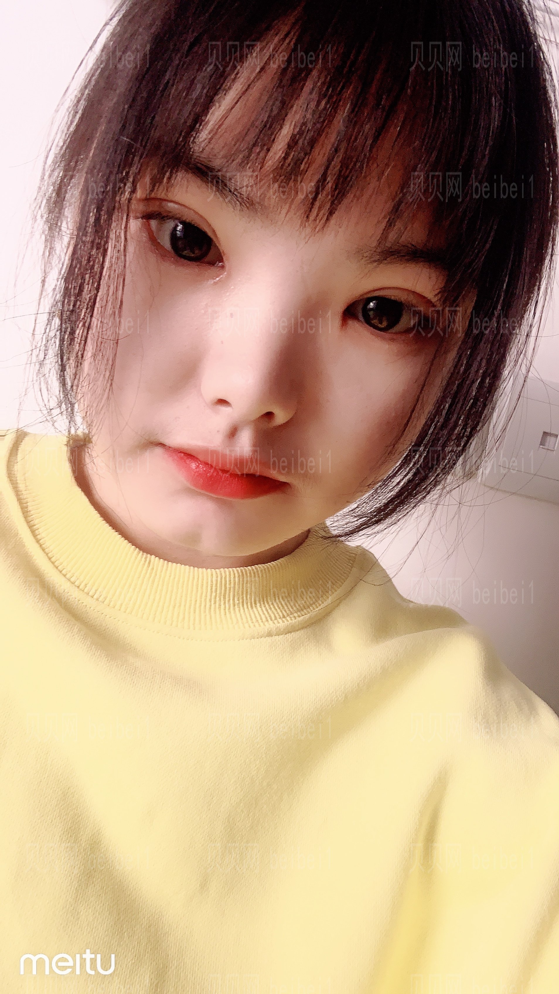 郑州大学第二附属医院整形科割双眼皮怎么样？哪个医生好？杨丽介绍好看吗？