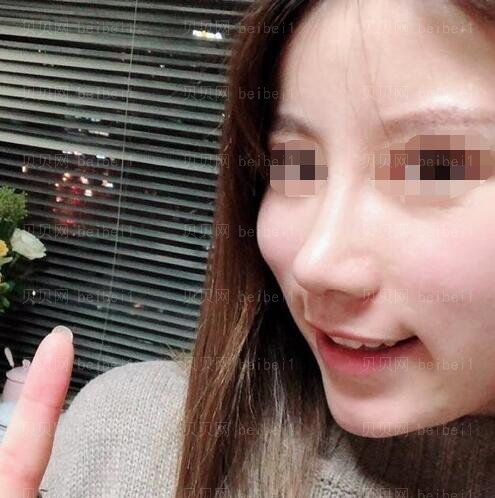 广州南方医院整形科隆鼻哪个医生好?罗勇技术怎么样?