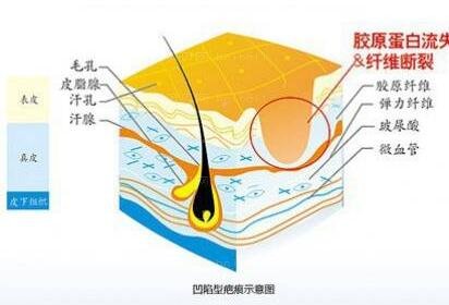 深圳鹏程医院疤痕技术怎么样？全新调节技术及介绍分享！