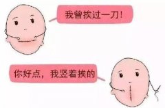 深圳鹏程医院疤痕技术怎么样？全新调节技术及介绍分享！