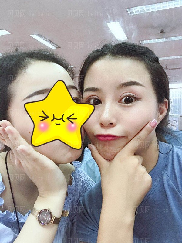 郭英宁的双眼皮怎么样