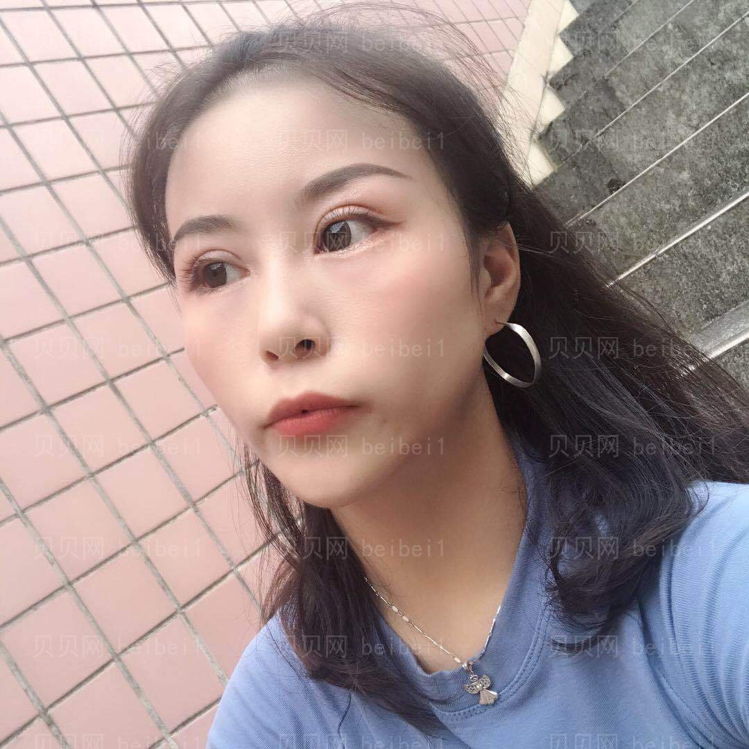 郭英宁的双眼皮怎么样