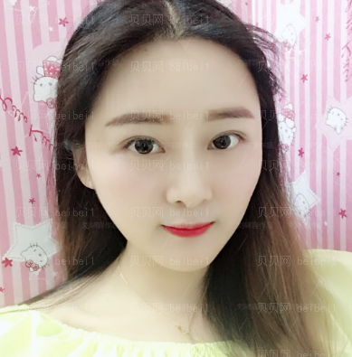 刘辅容双眼皮修复好吗？技术怎么样？