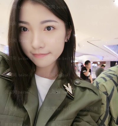 肖鸿双眼皮介绍