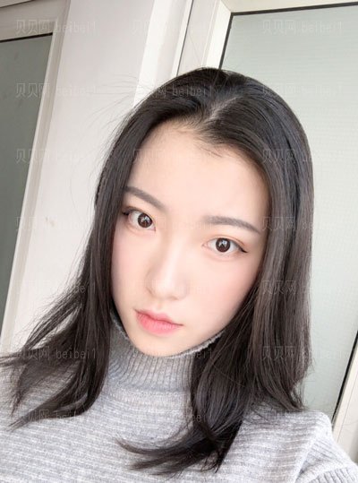 肖鸿双眼皮介绍